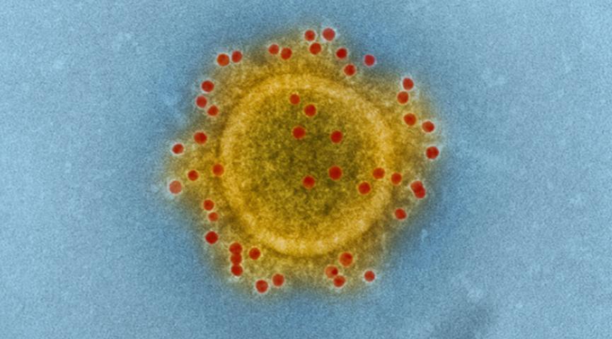 為什么Apple的指導修正與2019年相比引起了更少的恐慌